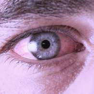 Орлиум справляется со всеми болезнями глаз